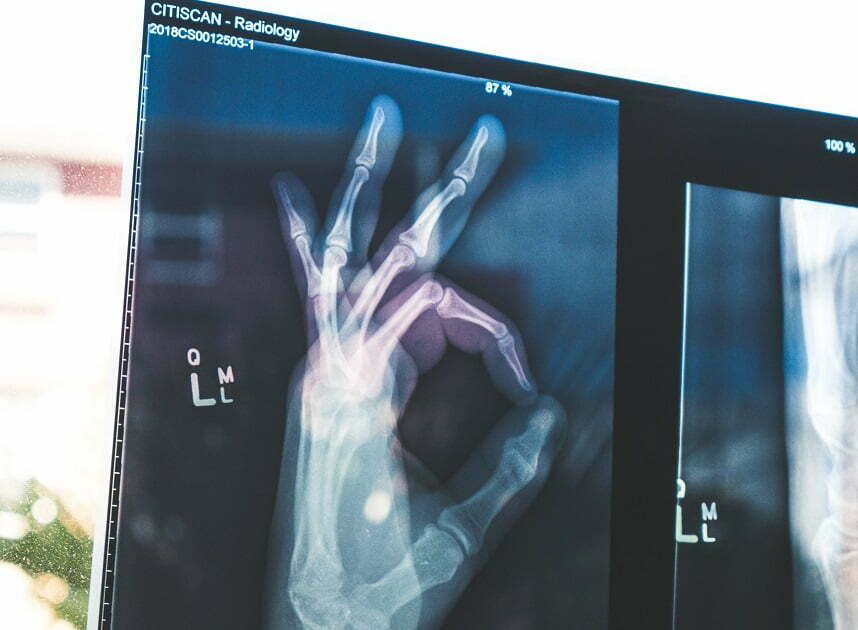 'OK' hand x-ray